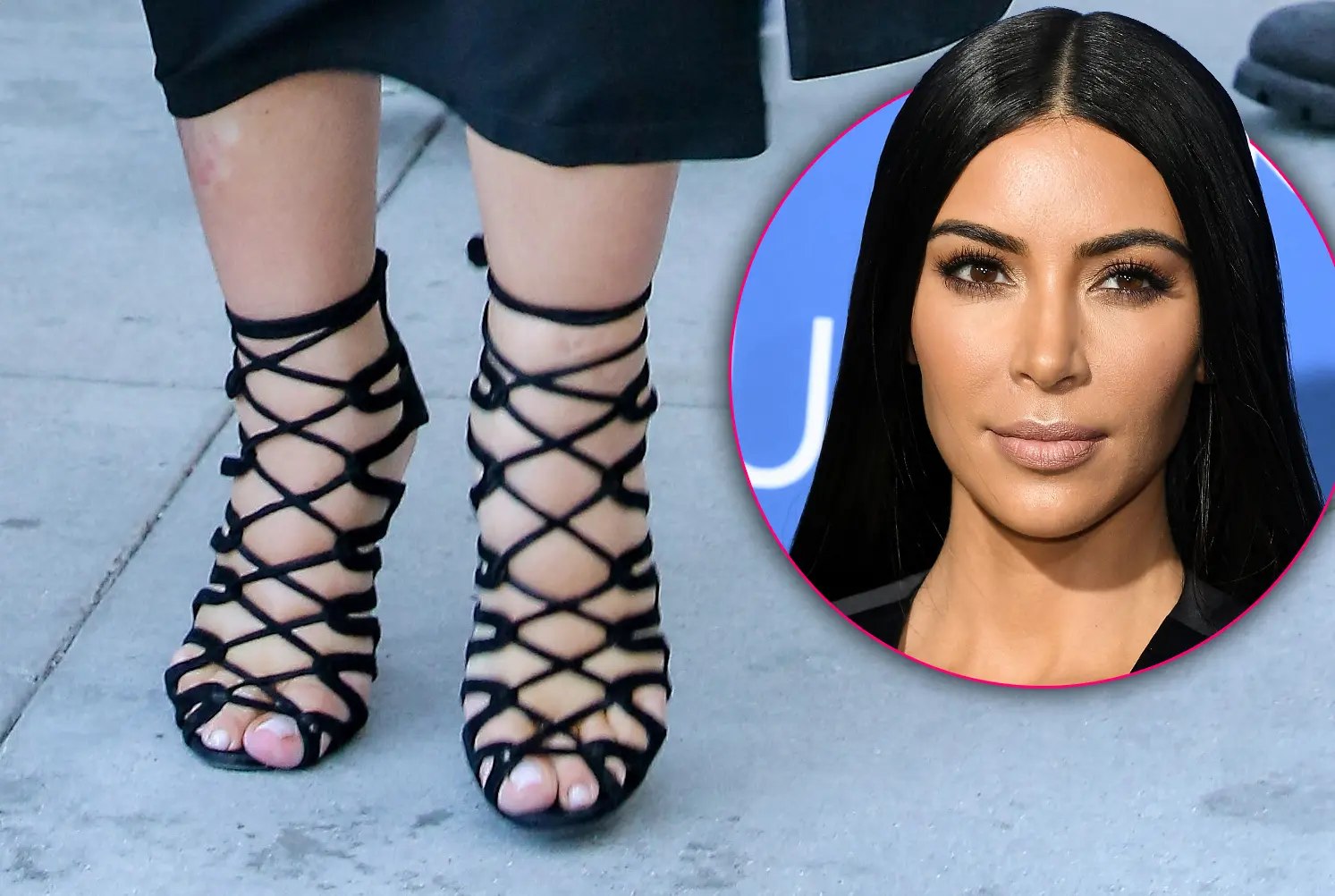 Kim Kardashian’s Feet: The Six-Toe Saga and Beyond